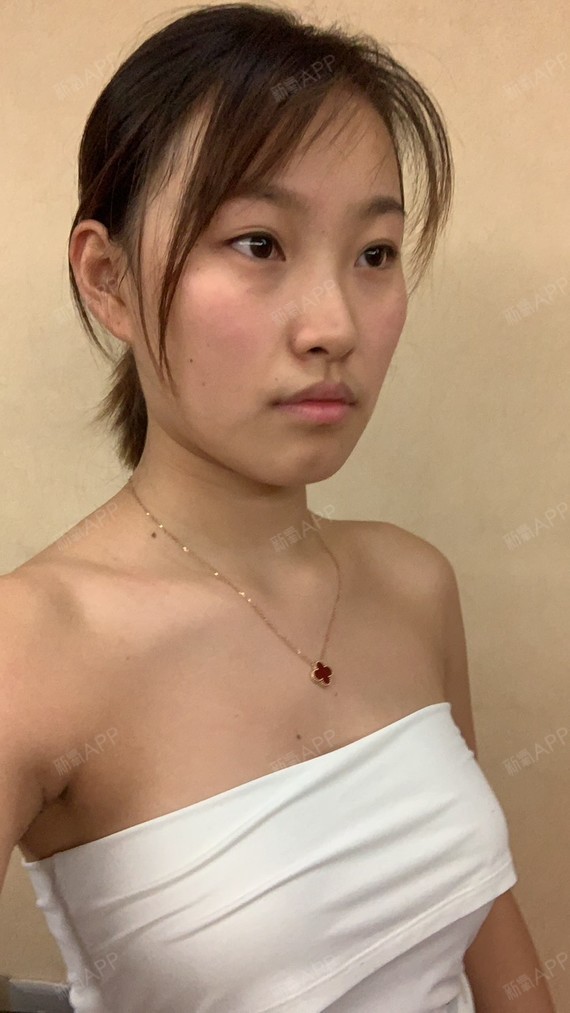 杭州假体隆胸好不好_效果图_小仙女i世俗的假体隆胸术后第7天_新氧