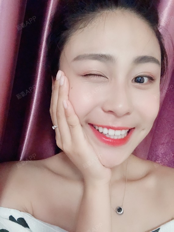 做的梨涡手术已经一个多月了,已经恢复得非常自然了哦_圈子-新氧美容
