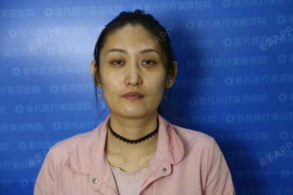 半永久纹眼线好不好_效果图_氧气xr0gn半永久