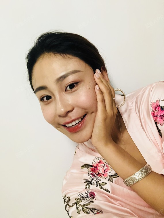 来写篇日记啦,做的梨涡成形术,术后1天,苏医生做的_圈子-新氧美容整形