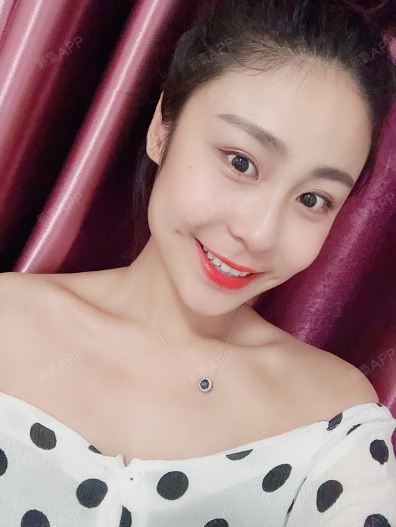 梨涡手术已经一个多月了,已经恢复得非常自然了哦_圈子-新氧美容整形