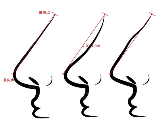 我在塑造鼻背曲线的过程中,就会根据这些数据处理,塑造出柔美的鼻背