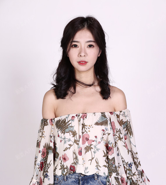 【杭州艺星假体隆胸术后166天】现在做胸都半年了,_圈子-新氧美容整形