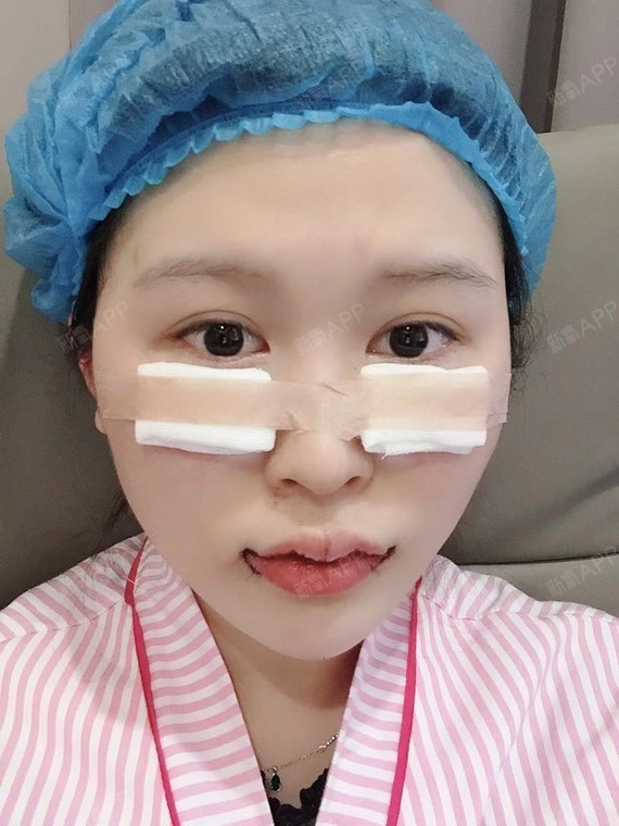 来自大海的小魔仙m唇手术第0天美丽日记