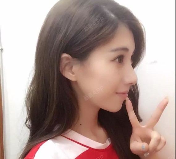 【鼻子长得丑是一种什么样的体验?30天,她逆袭