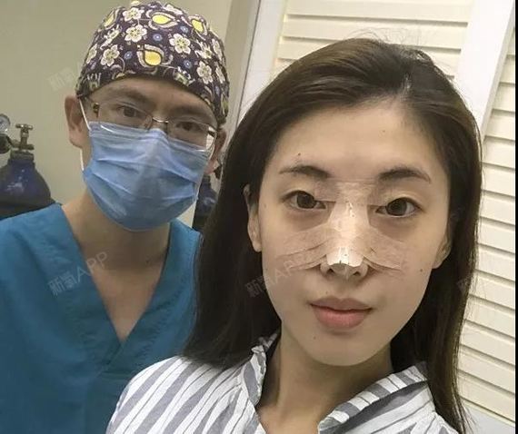 【鼻子长得丑是一种什么样的体验?30天,她逆袭