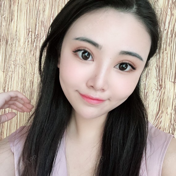 眼部多项好不好_效果图_大眼无敌哇眼部多项术后第60天_新氧美容整形