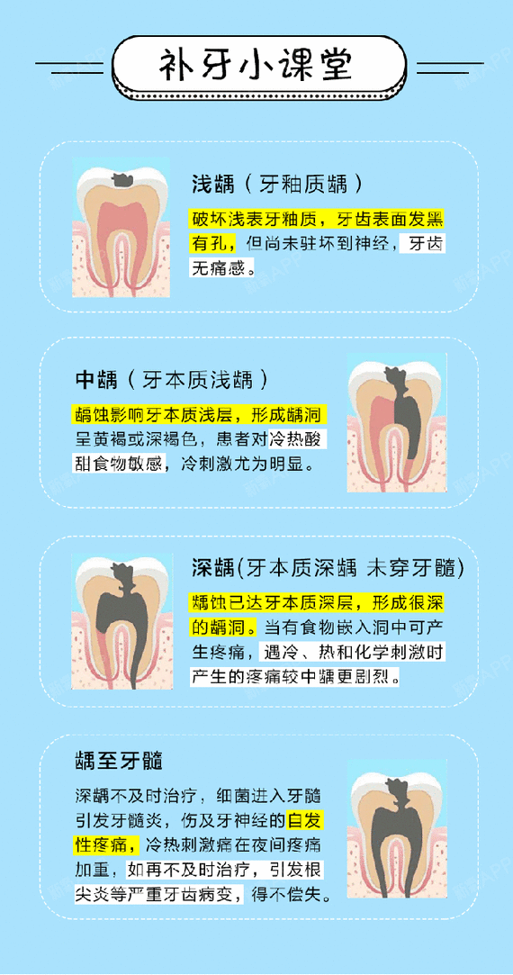 龋齿洞型分类6类图片