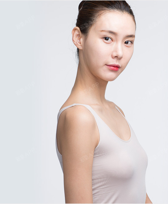 终于鼓足勇气做了丰胸手术,我的胸不仅小,还有点下