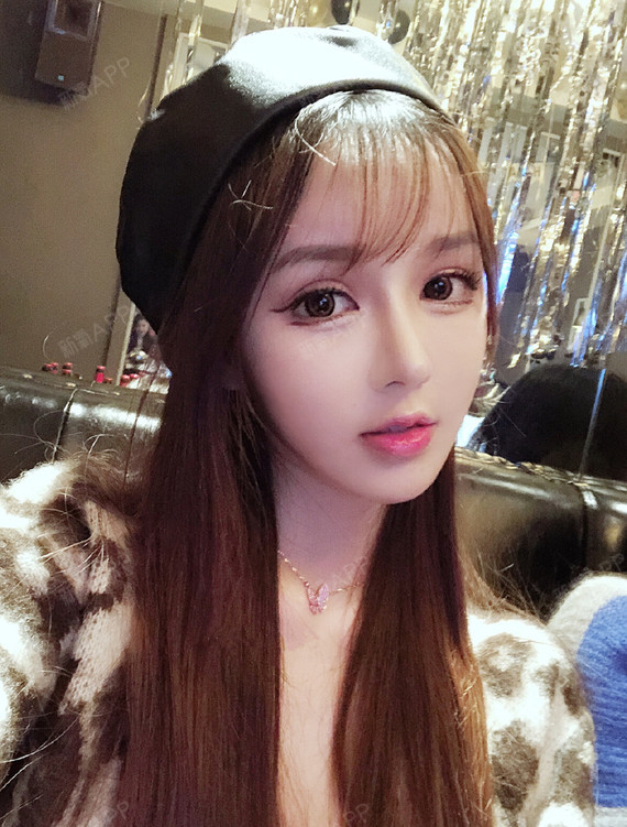 北京m唇手术好不好_效果图_annaaam唇手术术后第80天_新氧美容整形