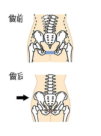 90神奇见证--产后恢复之盆骨闭合907215怀孕以后,随着宝宝在