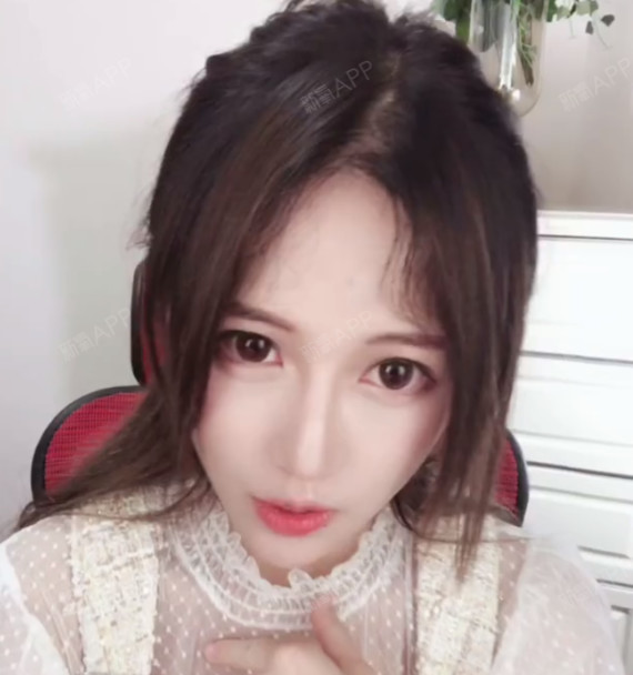 新氧- 丸子yooy | 毛发种植 | 种植发际线 | 术后当自强 | 深圳同城