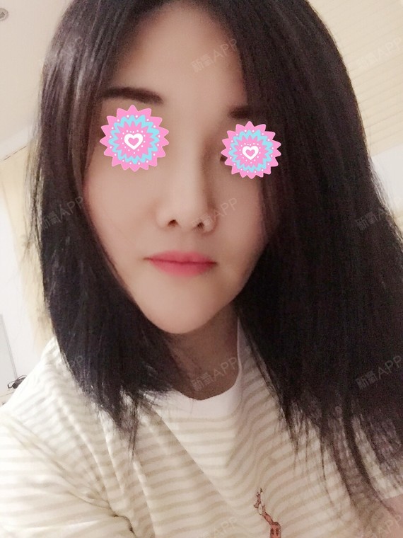 每个人脸部下垂的情况都不同,埋线的数量也会不同,越早做效果越好!