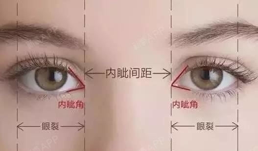 想要做流行的欧式双眼皮你需要拥有什么条件