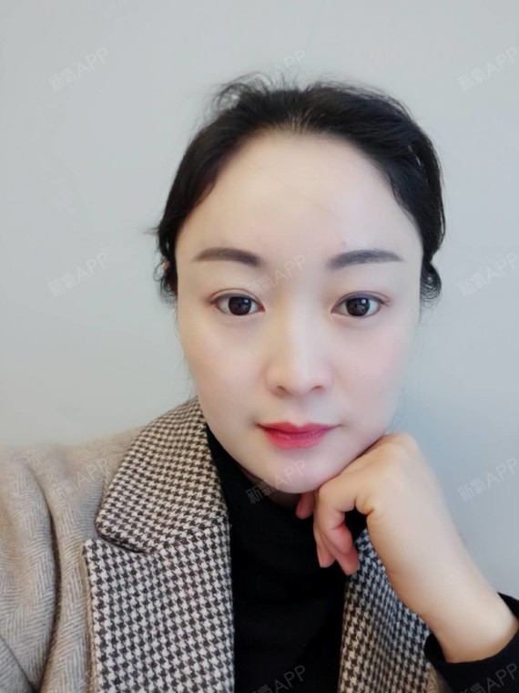 激光祛斑好不好_效果图_至味清欢激光祛斑术