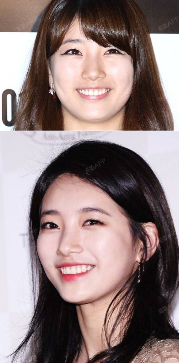 韩国女星整容已经不是什么新鲜事了