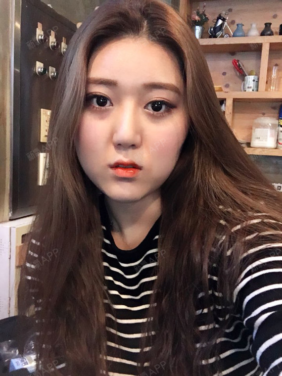 我的脸型比较有骨感,特别是颧骨四角颌,颧骨和下颌中_圈子-新氧美容