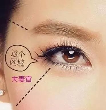 太阳穴凹陷,影响夫妻感情?听小美怎么说!