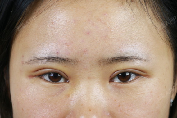 极致美容整形怎么样可靠吗（极致美容整形怎么样可靠吗安全吗） 极致美容整形怎么样可靠吗（极致美容整形怎么样可靠吗安全吗） 整形美容