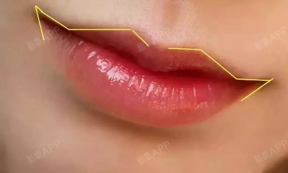 有唇珠的嘴唇,微闭微张时,唇珠非常的明显,两唇之间的弓形弧度很美.