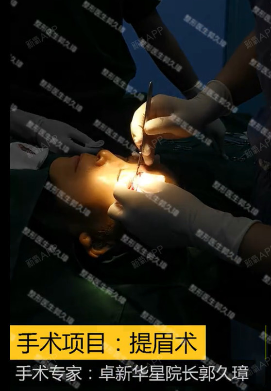 切眉效果_切眉后纹眉效果图片_文眉切眉