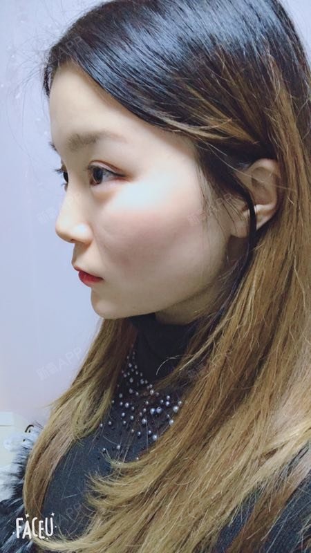 现在越来越喜欢拍照了,额头饱满侧面线条非常好看,也_圈子-新氧美容