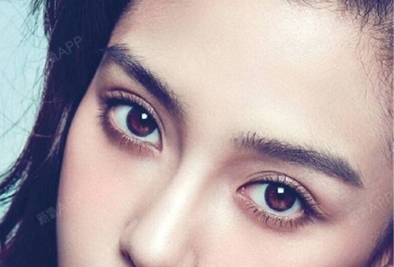 为什么双眼皮与开眼角最好一起做!不听医生言吃亏在眼前