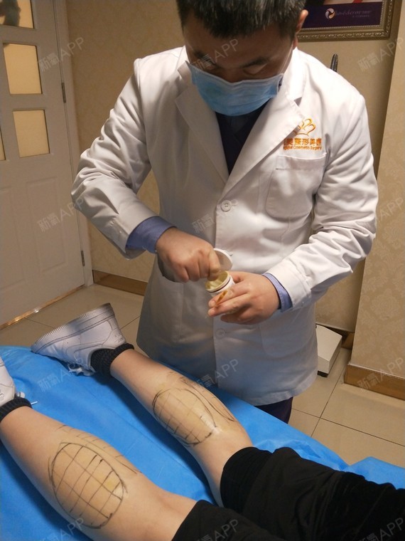 本小可爱来啦~~[:92][:92]注射瘦腿针第四_圈子-新氧美容整形