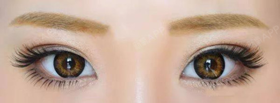 双眼皮只有_圈子-新氧美容整形