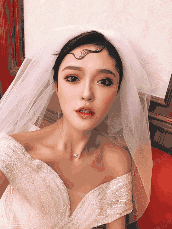 sally柒儿自体脂肪全脸填充术后第121天美丽日记_新氧整形