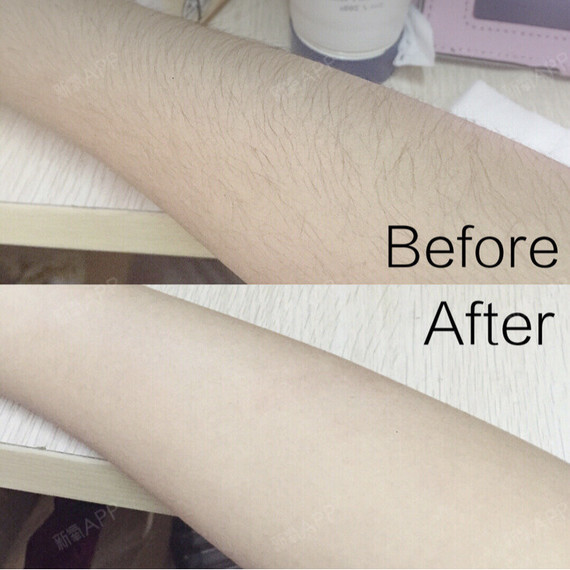 你这一辈子有没有为脱毛拼过命!不好意思,我有!