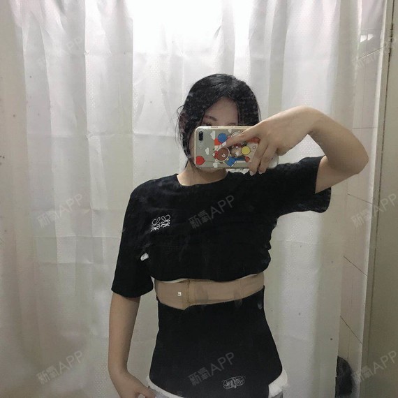 腹壁成形术好不好_效果图_分分钟美到你腹壁成形术术后第7天_新氧美容