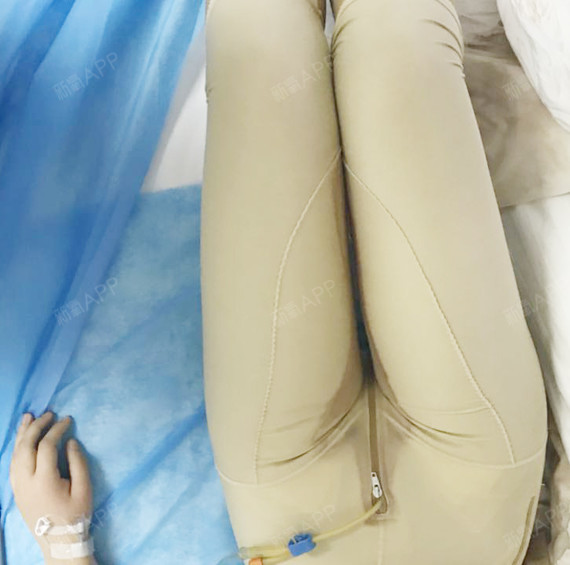 氧气zors3吸脂瘦大腿第1天美丽日记