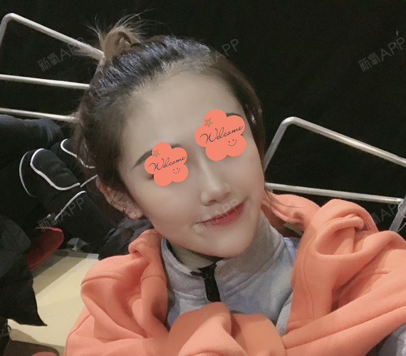 艺星美容整形瘦脸针（艺星整形瘦脸针多少钱） 艺星美容整形瘦脸针（艺星整形瘦脸针多少钱）《艺星整形价格表》 整形美容