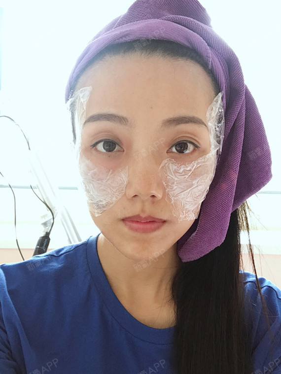 我一脸?褐青色痣是什么鬼?