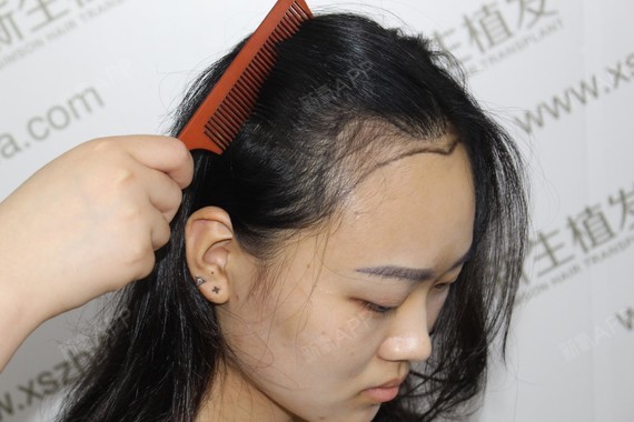 并不是所有人发_圈子-新氧美容整形