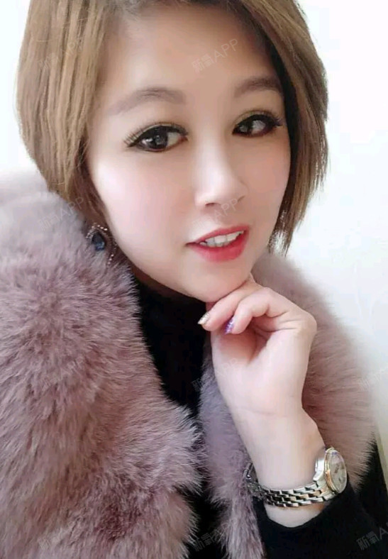 【西华私密矫正第161天】大家好,好久没有来看大家_圈子-新氧美容整形