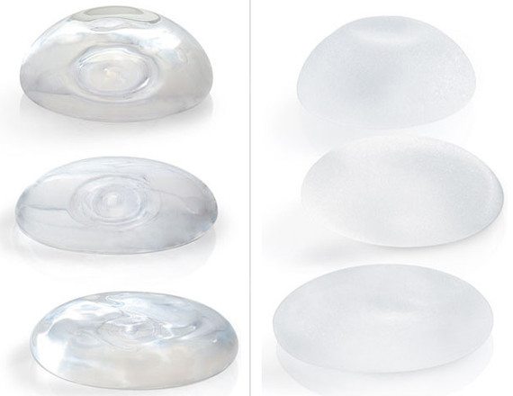 自体脂肪丰胸与假体丰胸的"攀比"记录曝光了!