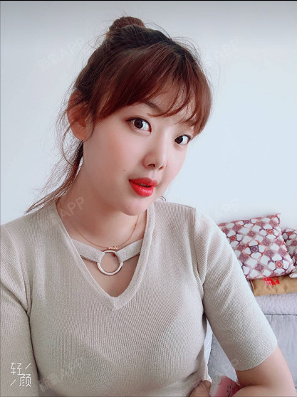 新氧- 守护077 | 胸部 | 隆胸 | 假体隆胸 | 术后当自强 | 新乡同城