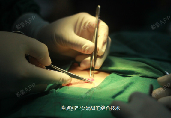 盘一盘那些惊呆你的女娲级缝合术