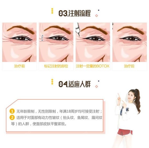 1,除皱针注射时间短,其过程舒适.