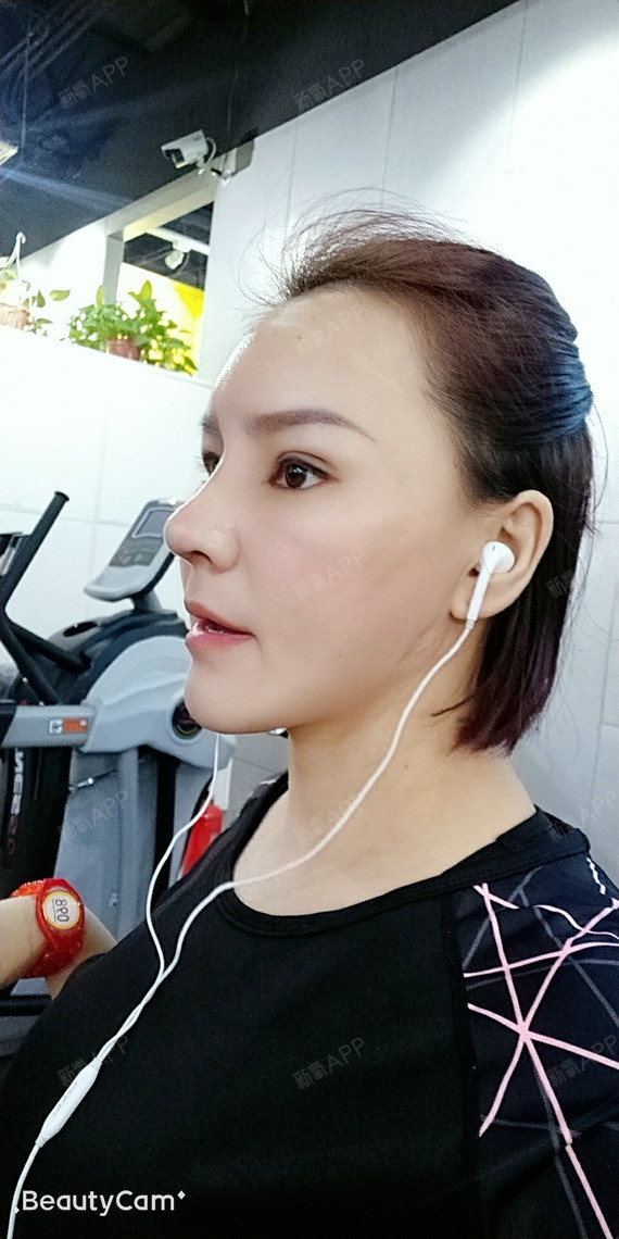 现在看鼻子已经恢复快差不多了,我没能抓住跨年的尾巴,但是我希望我的