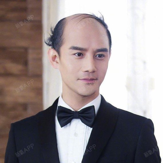 秃顶帅哥vs浓密丑男你会选择谁.[:_圈子-新氧美容整形