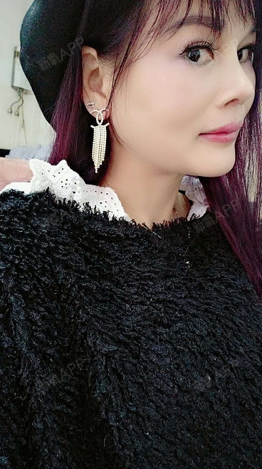 广西壮族自治区南宁假体隆胸好不好_效果图_变美路上有你相伴假体隆胸