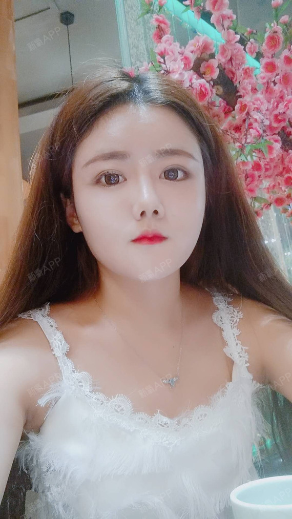 【伊颂自体脂肪填充日记】大家好呀大家好,我来爆照啦_圈子-新氧美容