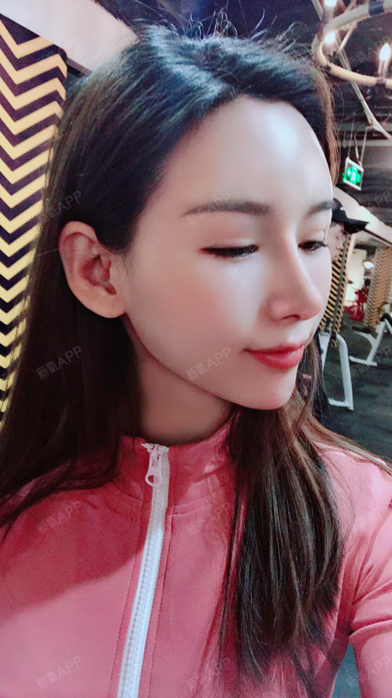 【沈阳童颜】【鼻综合】