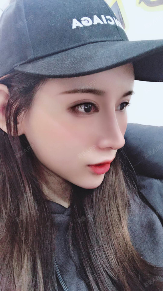 【沈阳童颜】【鼻综合】