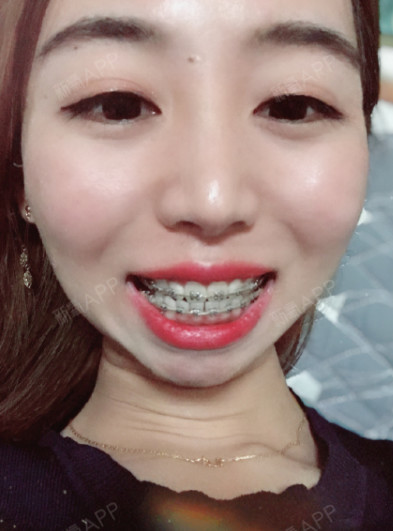 好想要一个兜财的下巴啊!