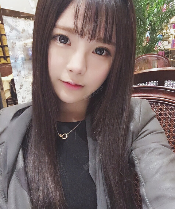 一箭穿了两颗心小阴唇手术第34天美丽日记-新