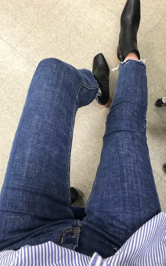 喝过大碴粥吗吸脂瘦大腿第125天美丽日记